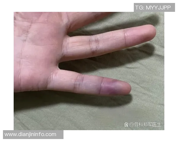 打篮球时手被戳了该如何处理和预防受伤的有效方法分享